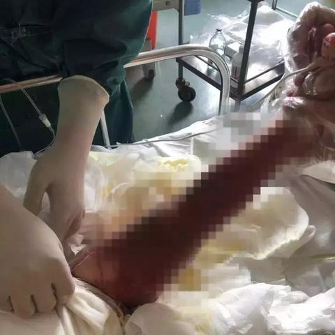 最新休克诊断标准解读