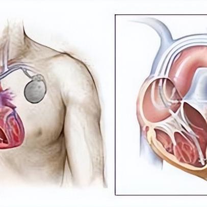 肾病新疗法重塑治疗格局，未来展望与进展