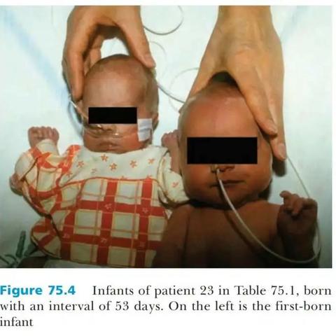 宫颈评分表最新解读