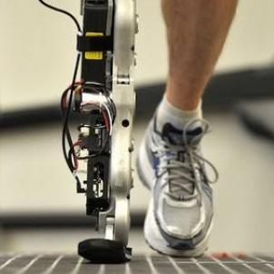 智能假肢手技术重塑生活品质,革命性创新引领未来